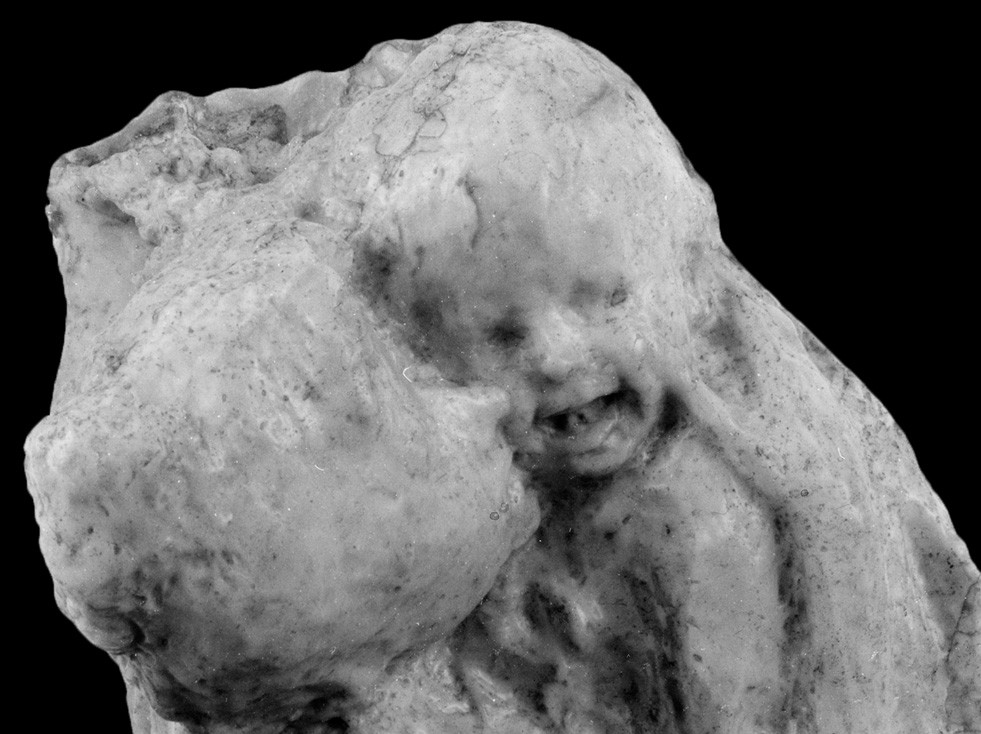Medardo Rosso, Aetas Aurea